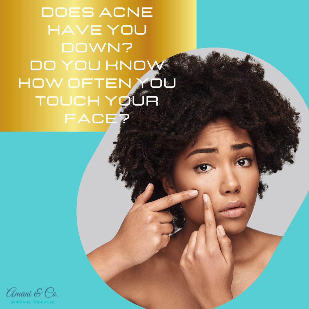 Is stressed related to your acne?